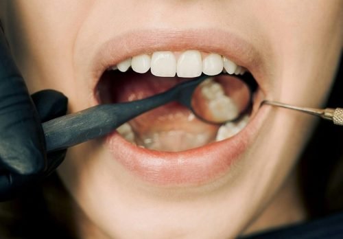 Dental hygiene services